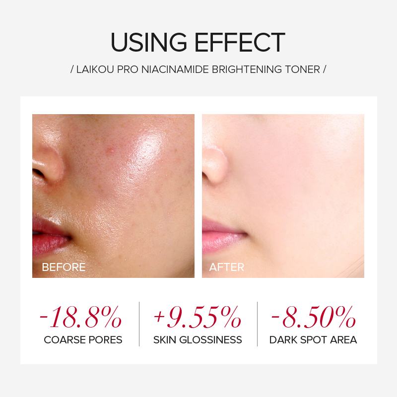 LAIKOU PRO Niacinamide 4-delig - Skincare Garnier recensie en prijs