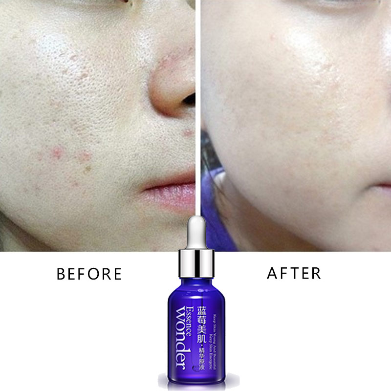 Bioaqua Blueberry Gezicht Lift - Skincare Garnier recensie en prijs