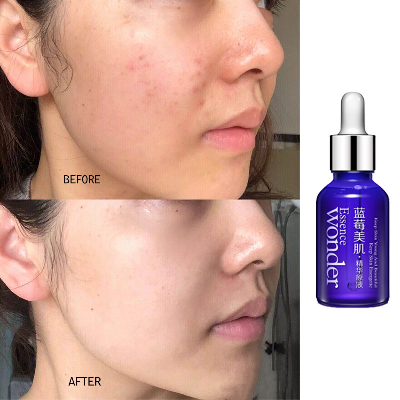 Bioaqua Blueberry Gezicht Lift - Skincare Garnier recensie en prijs