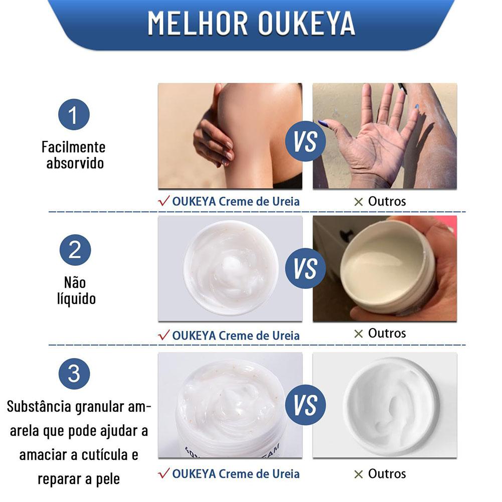 Ureacrème 40% Hydraterende Ant - Urea Foot Cream recensie en prijs