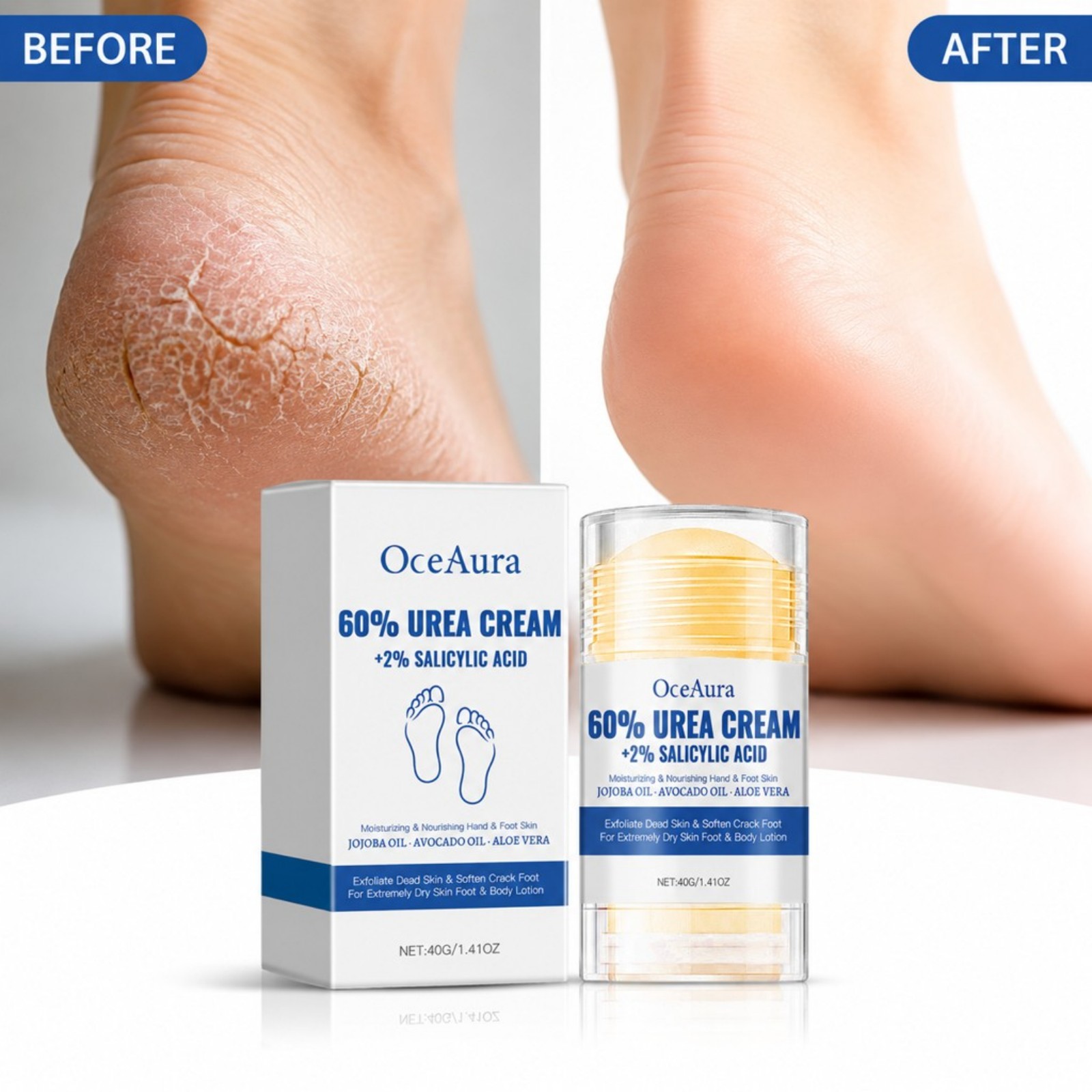 60% Urea Voetverzorgingscrème  - Urea Foot Cream recensie en prijs