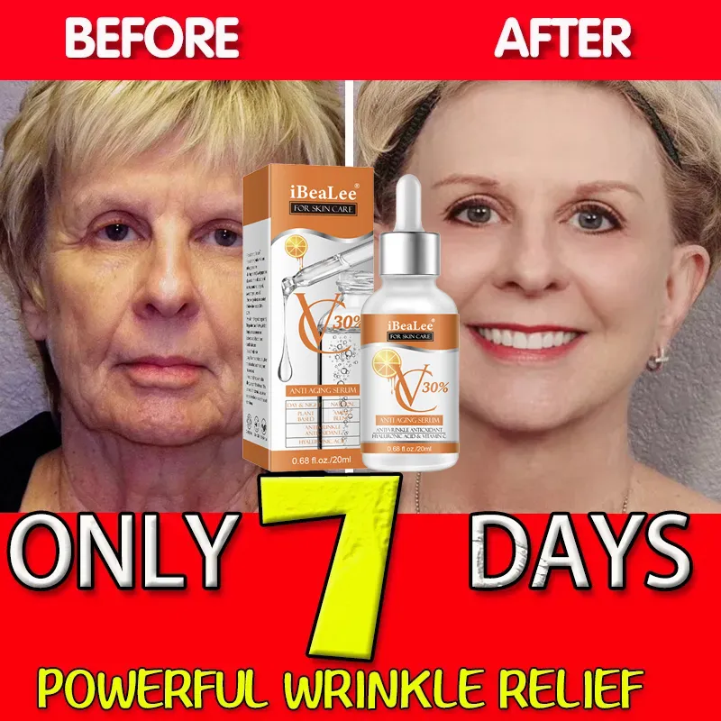 Premium 30% Vitamine C Serum V - Skincare Garnier recensie en prijs
