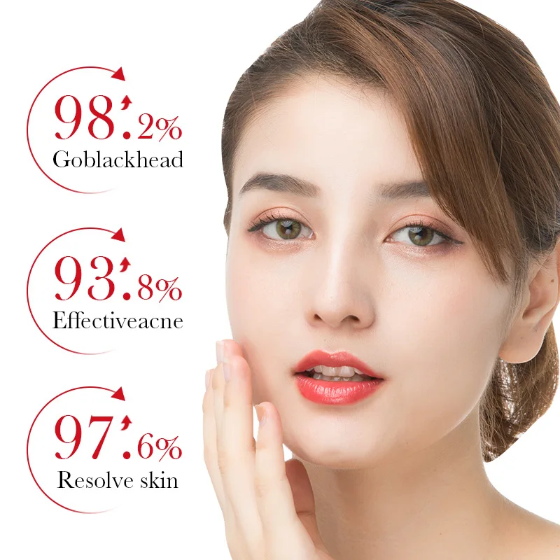 BIOAQUA Salicylzuur Acne Verwi - Skincare Garnier recensie en prijs