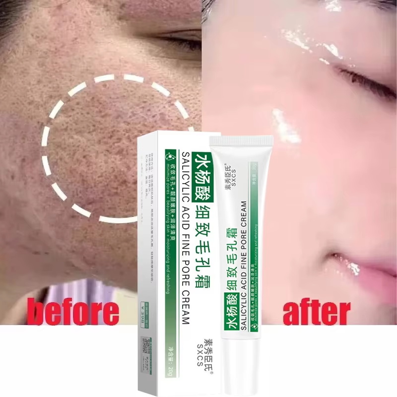 Salicylzuur poriënverfijnende  - Azelaic Acid Cream recensie en prijs